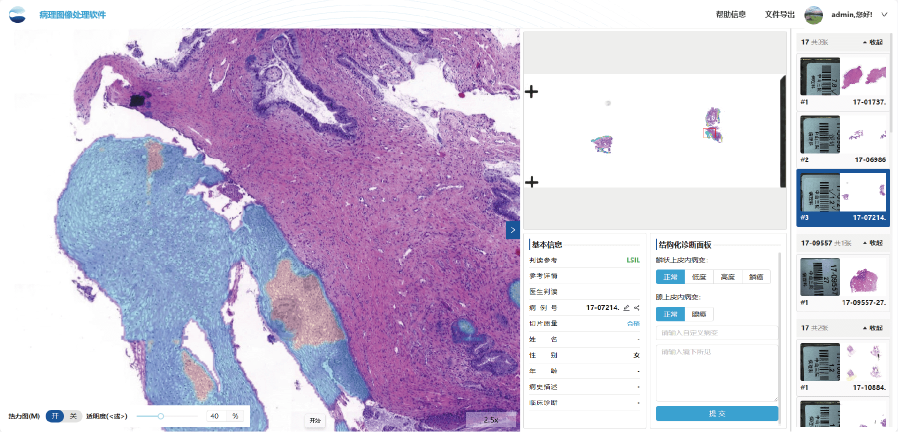 cervix_tissue