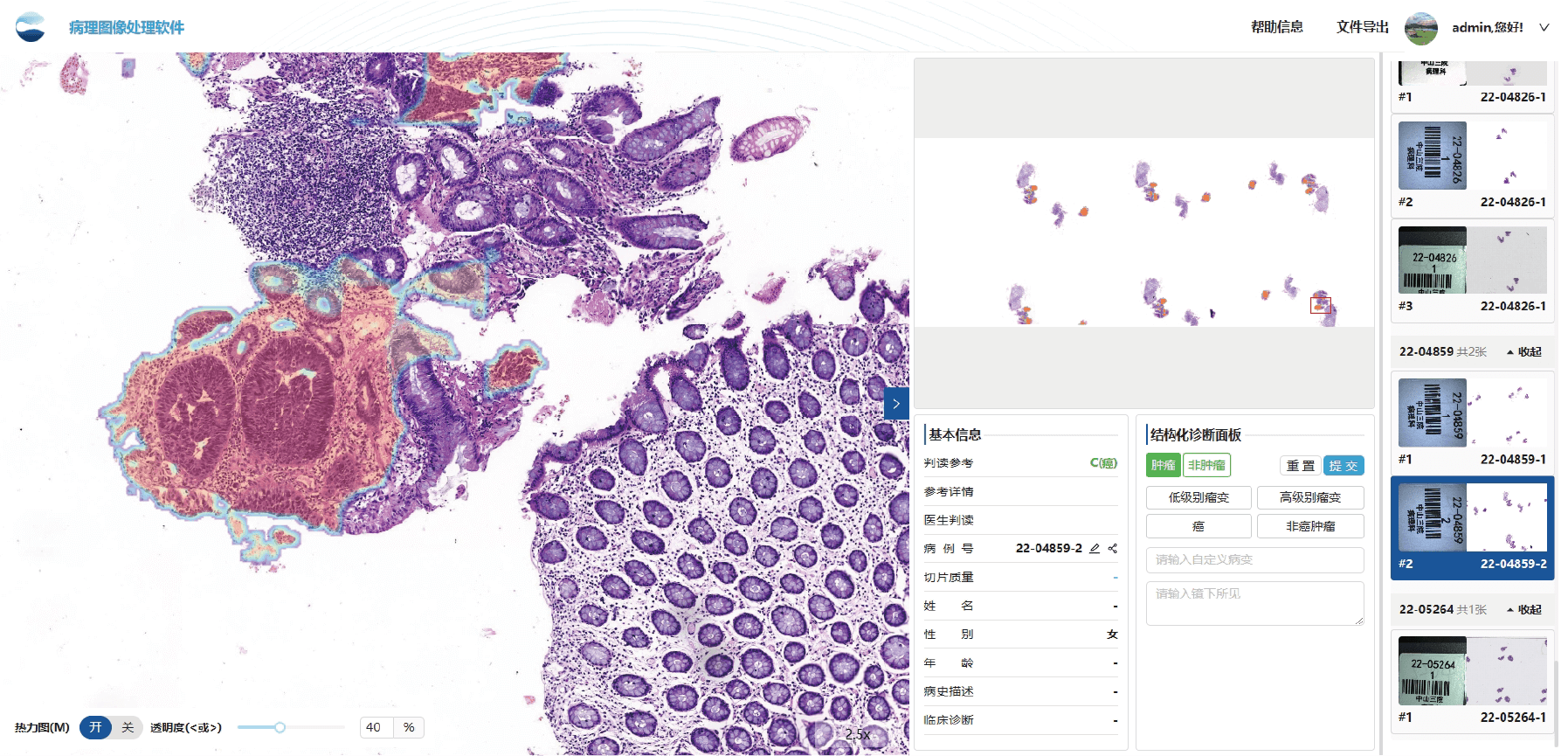 colon_tissue